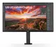 LG 32UN880K-B #2